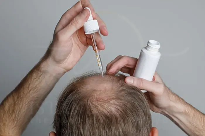 Does Hims Work for Hair Loss Treatments, Costs & Reviews