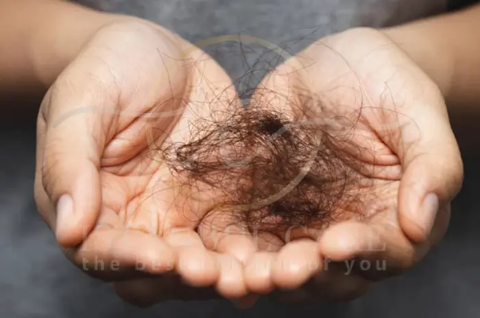 Does Levothyroxine Cause Hair Loss Effects, Prevention & Treatment