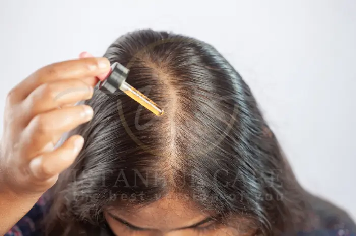 Finasteride and Minoxidil Finasteride and Minoxidil