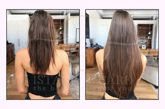 Natural-hair-growth-remedies Natural hair growth remedies