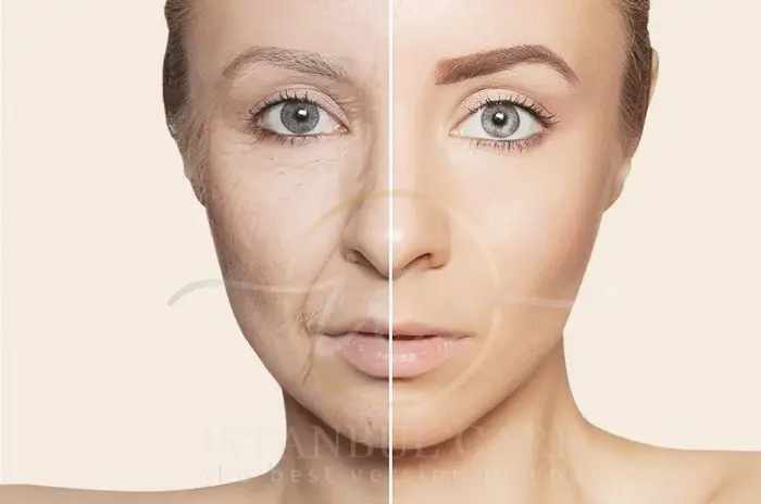 facial skin after weight loss facial skin after weight loss
