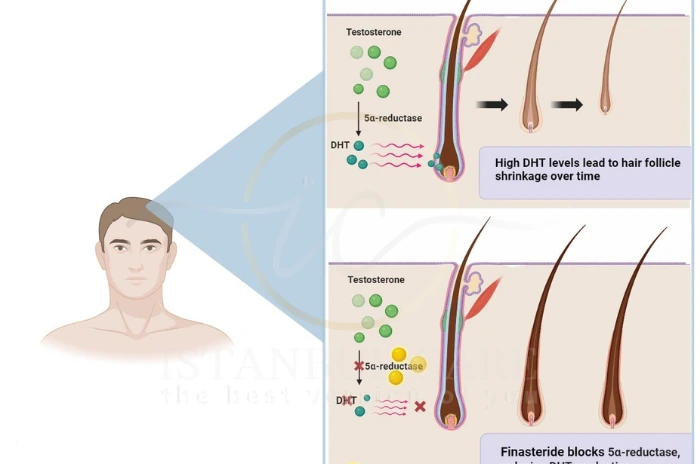 finasteride oral route finasteride oral route