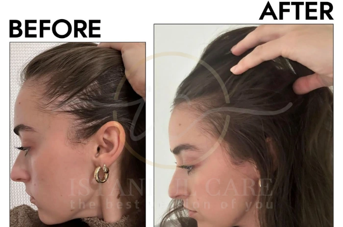 hair growth supplement hair growth supplement