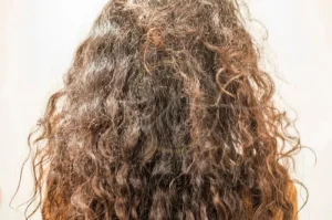 Gray and White Hair Causes