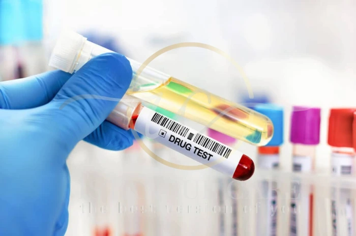 Hair drug testing Hair drug testing