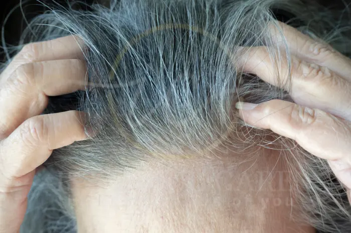 Solutions for hair graying