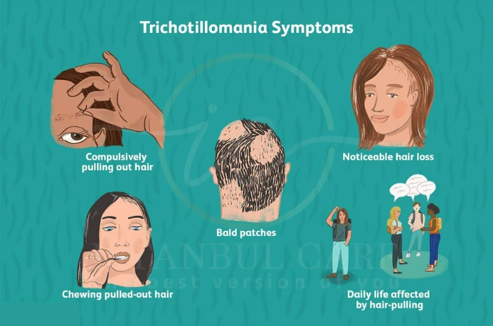 Symptoms of trichotillomania Symptoms of trichotillomania