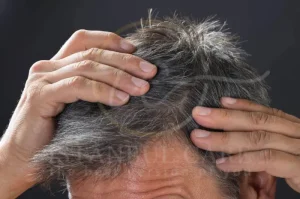 Grey Hair turn to White