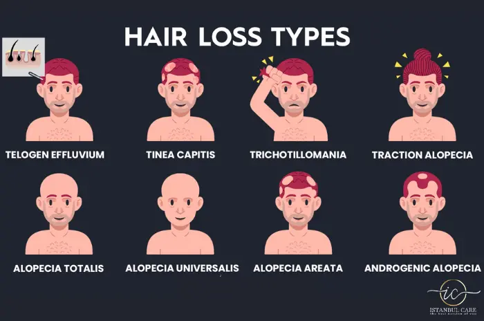 hair loss treatment for women_ hair loss treatment for women