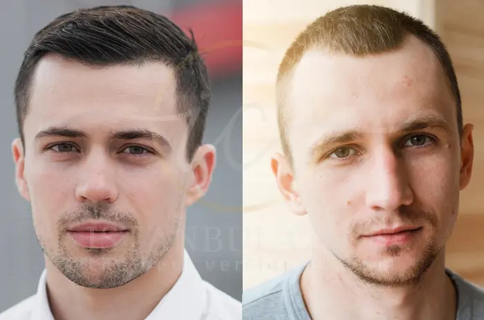 haircuts to hide receding hairline haircuts to hide receding hairline