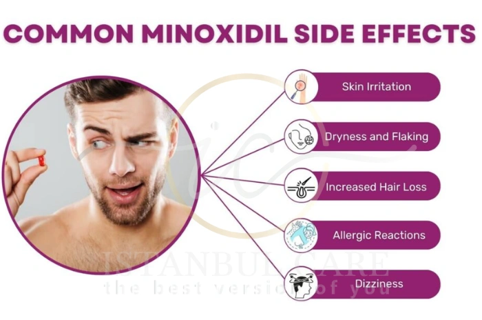 minoxidil for hair loss