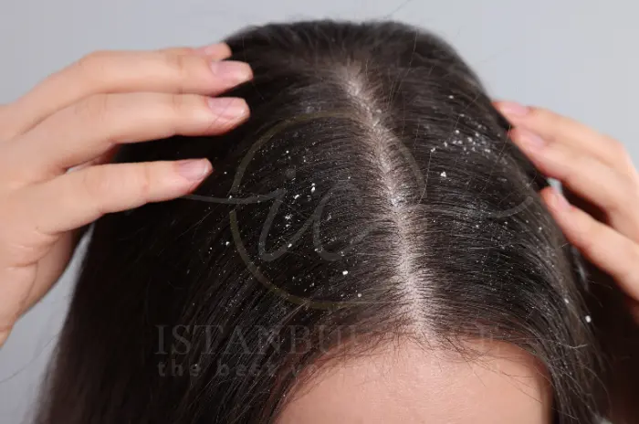 selenium DS dandruff shampoo selenium DS dandruff shampoo