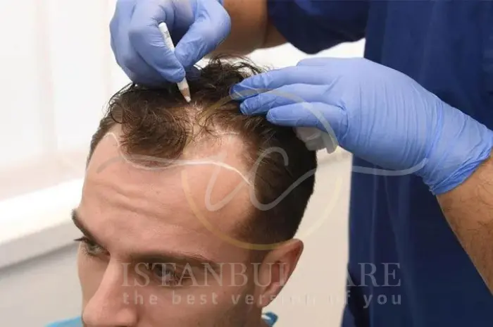 stem cell hair treatments stem cell hair treatments