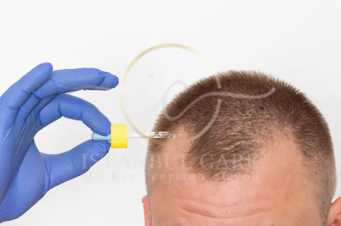 How to Apply Minoxidil