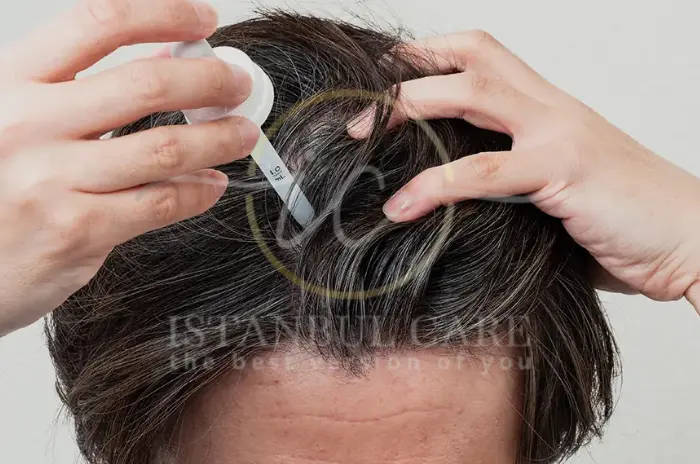 How to Apply Minoxidil - Avoid These Common Mistakes When Applying Minoxidil Minoxidil Application
