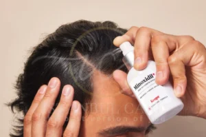 Haartransplantation,haartransplantation türkei - Startseite Minoxidil for hair loss