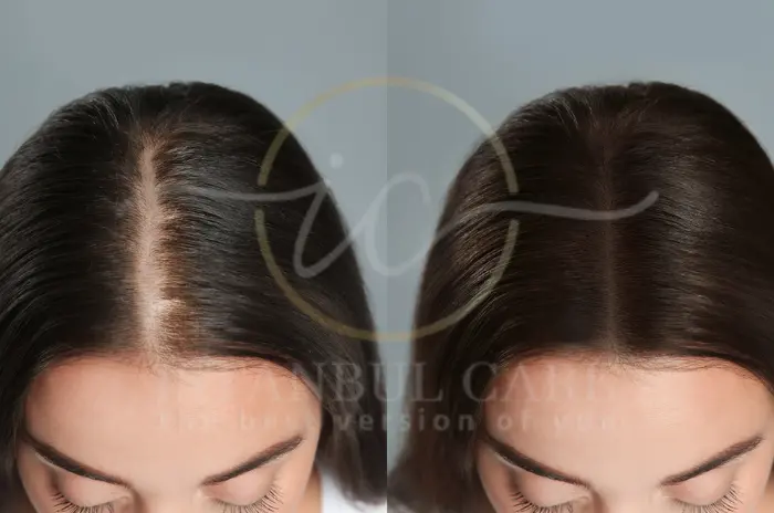 What to Know About Regenerative Hair Growth Solutions