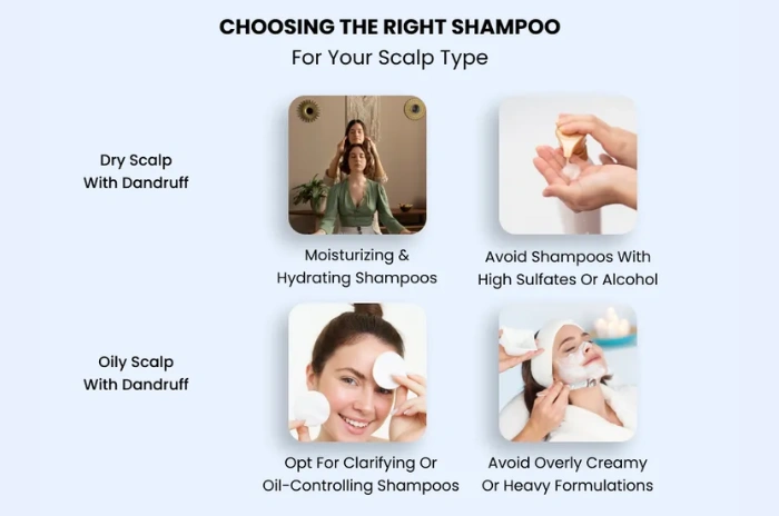 anti dandruff shampoo anti dandruff shampoo