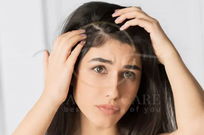 Adderall Causes Hair Loss