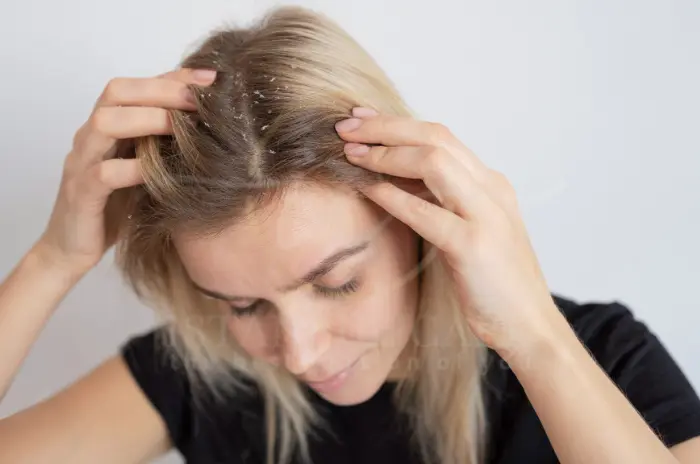 How to Fix Dry Scalp