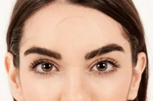 Minoxidil for Eyebrows Facts on Growth Benefits and Safety