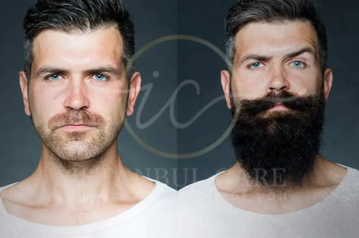 Optimal Beard Growth Tips