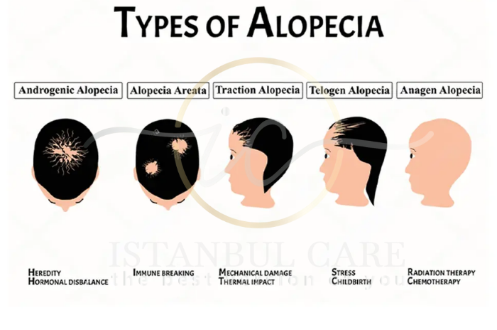 Scarring alopecia