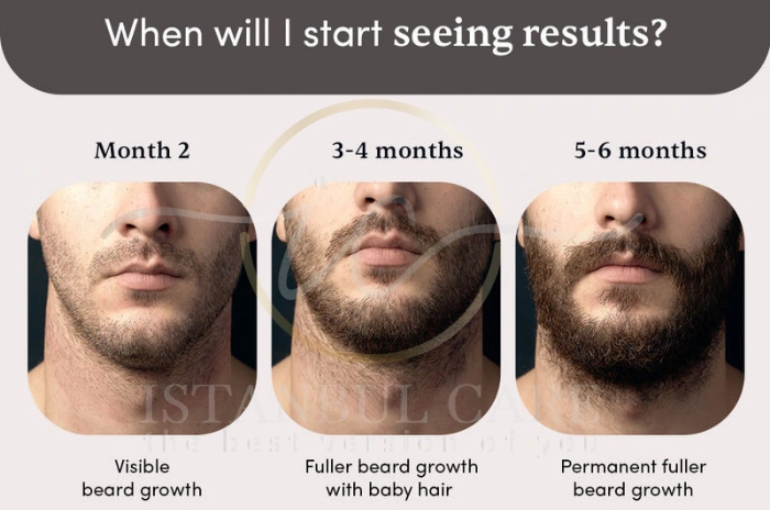 minoxidil beard before and after minoxidil beard before and after