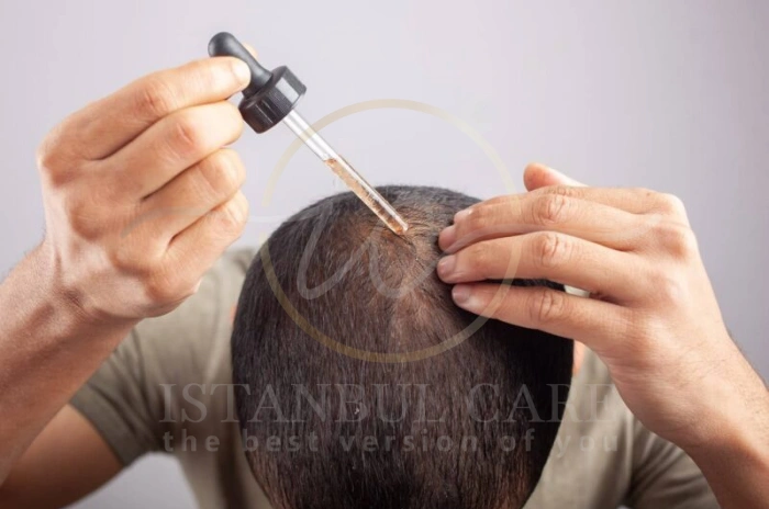 Norwood 3 non-surgical treatment Norwood 3 non-surgical treatment